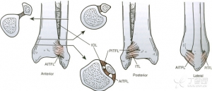 JBJS概念回顾：踝关节下胫腓联合韧带损伤