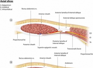 腹壁外科医生必备解剖学知识：后壁分离术的解剖概念和手术步骤专家共识