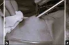经脐腹腔镜辅助阑尾切除术对儿童的效果优于腹腔镜阑尾切除术吗？一项随机对照研究