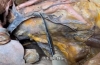 胰腺脾脏十二指肠EHPT腹腔干SMA IMA动脉和临床