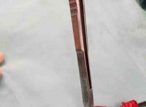 早期结肠准备及挽救性腹腔镜阑尾切除术 (ECSLA)——处理磁铁误食的创新方案