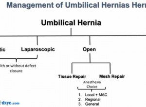 21世纪成人择期脐疝修补术：挑战现状