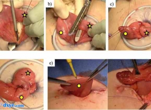 临时回肠造口术降低造口出口阻塞的风险：接受修复性直肠结肠切除术和回肠袋肛管吻合术