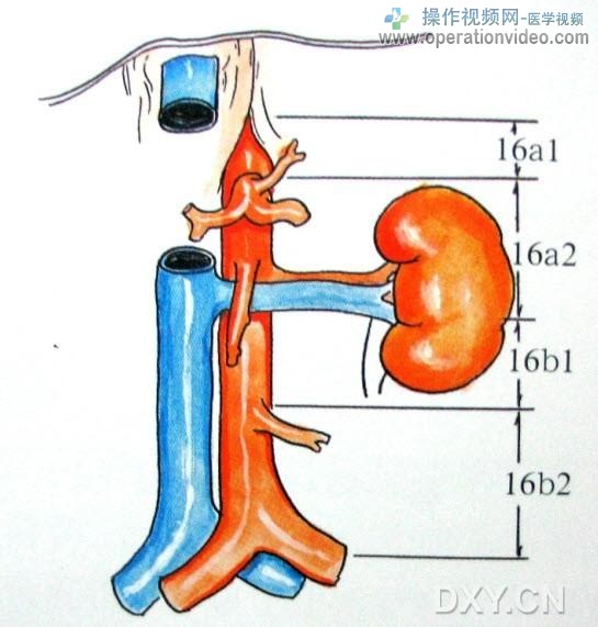 腹主动脉周围淋巴结腹主动脉周围淋巴结（No.16）分布较广泛，以左肾静脉上缘为界分为.jpg