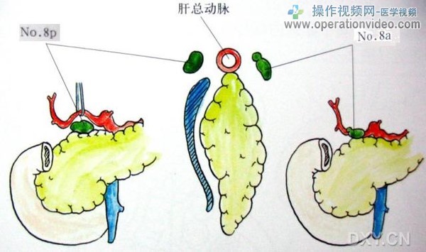 肝总动脉干淋巴结肝总动脉干淋巴结（No.8）分布于肝总动脉干上。位于肝总动脉前面淋巴.jpg