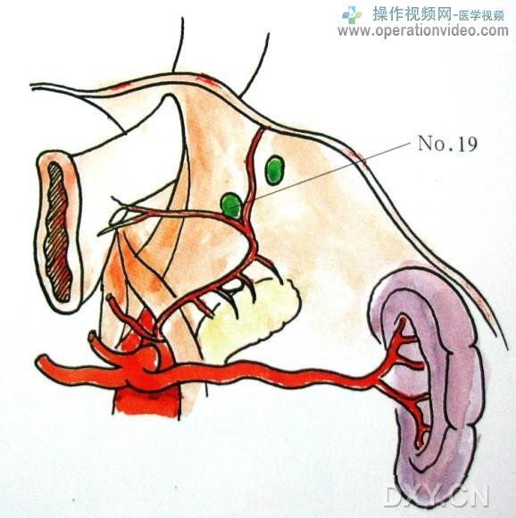 膈下淋巴结膈下淋巴结（No.19）位于膈肌腹侧面，主要沿膈下动脉分布.jpg