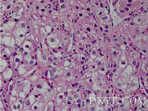 Figure 2: Representative figure of biopsy histology.