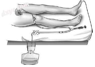 PANEL C, Intravesical pressure Monitoring.jpg