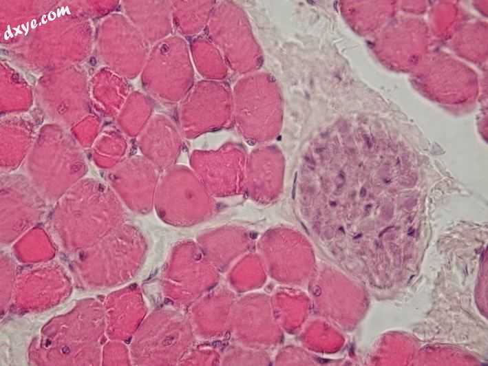 Cross section through skeletal muscle and a small nerve at high magnification (H.jpg