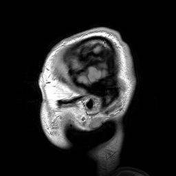 Modern anatomic technique showing sagittal sections of the head as seen by a MRI scan.gif