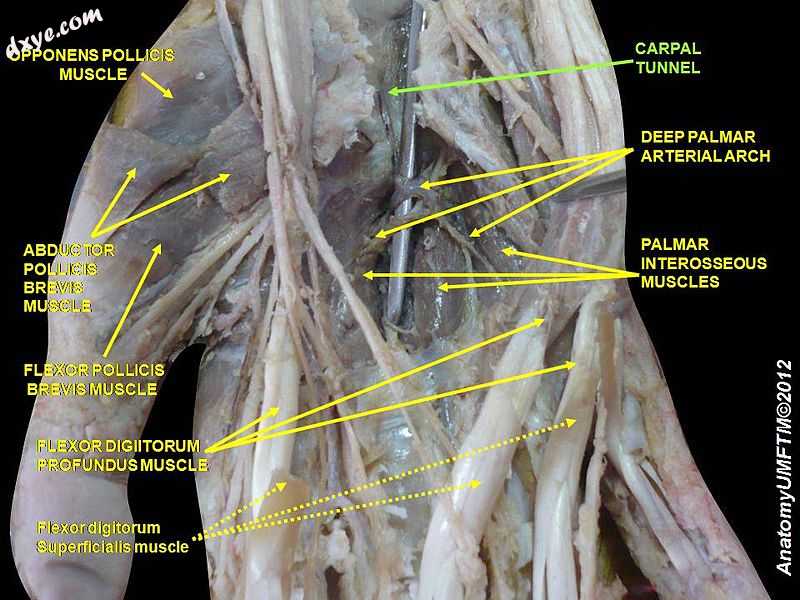 Carpal tunnel2.jpg