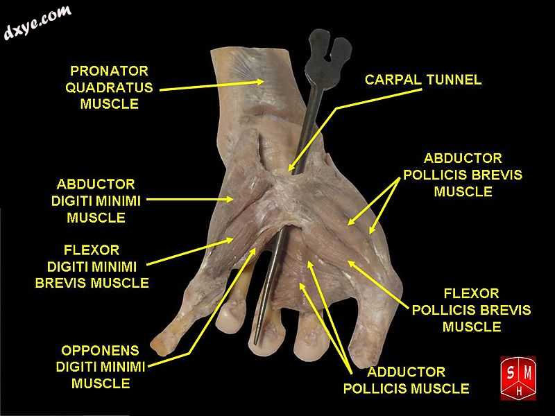 Carpal tunnel3.jpg