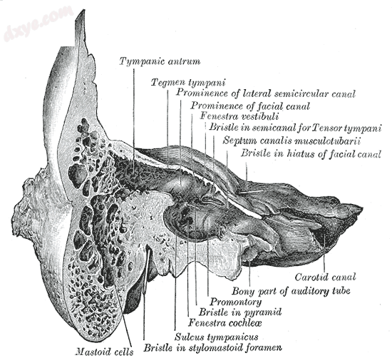 Coronal section of right temporal bone. (乳突小房 labeled at bottom left.).png