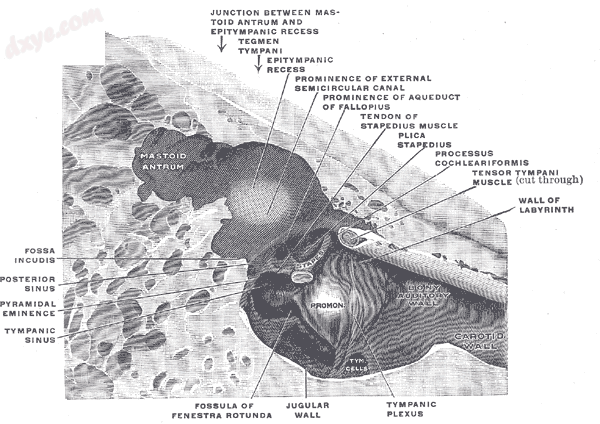 The medial wall and part of the posterior and anterior walls of the right tympan.png