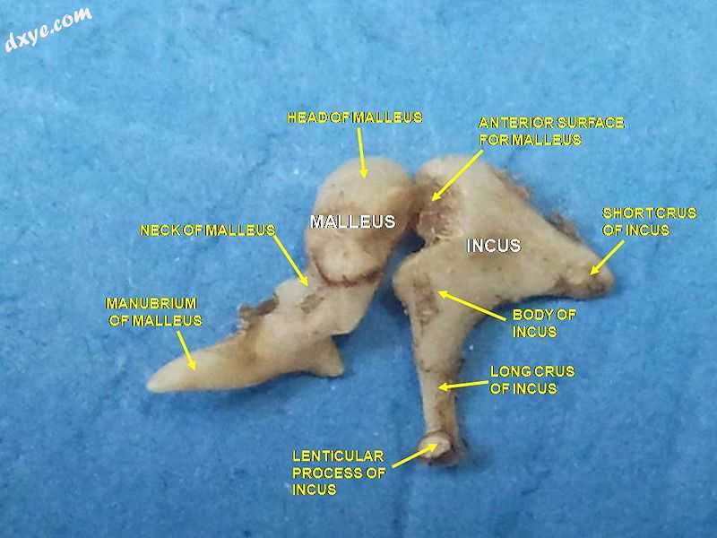Auditory ossicles. 砧骨 and 锤骨. Deep dissection..jpg