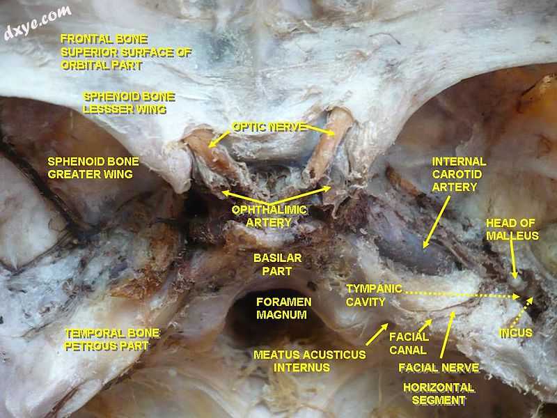 Tympanic cavity. Facial canal. Internal carotid artery..jpg