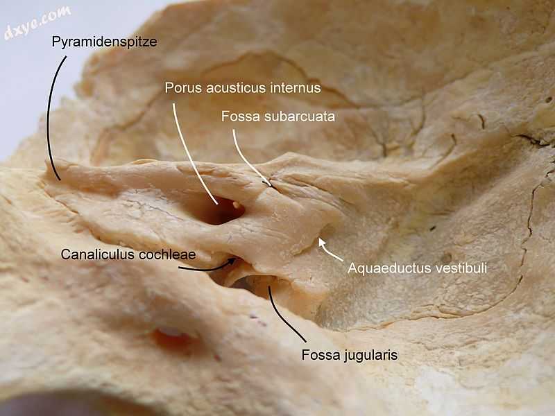 Temporal bone.jpg