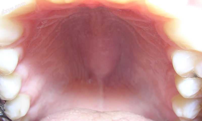 Oral palate unit.jpg