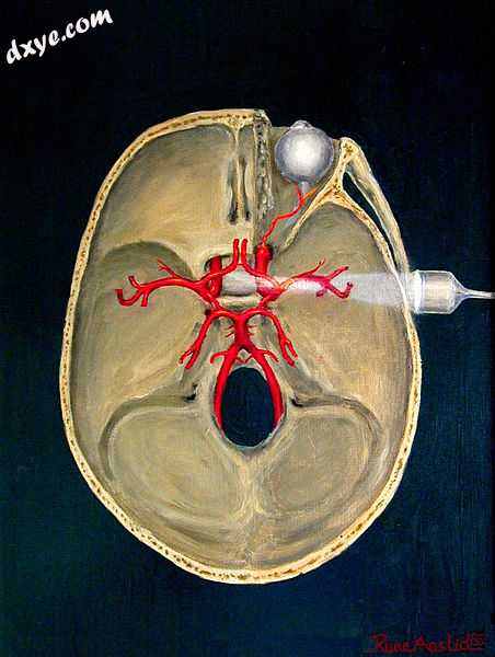 Transcranial Doppler insonation of the cerebral circulation.jpg