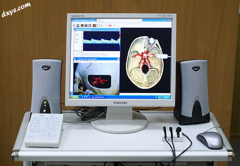 Transcranial doppler ultrasound analyzer of blood velocity.jpg