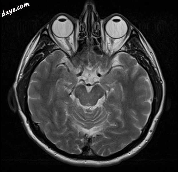 Brain MRI.jpg