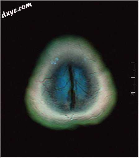 False color MRI by applying red to T1, green to PD and blue to T2..jpg