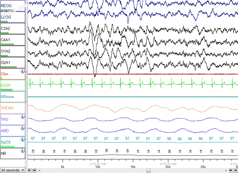 Electrophysiological recordings of stage 3 sleep.png