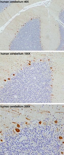 Purkinje cells in the human 小脑 (in orange, from top to bottom 40X, 100X .jpg