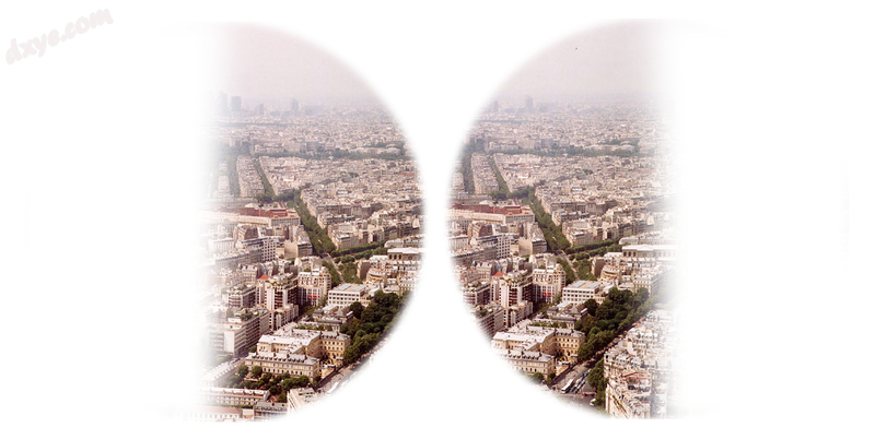 Views of Paris showing vision with loss of both temporal visual fields.png