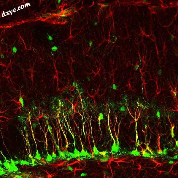 Neural stem cells seen in green.jpg