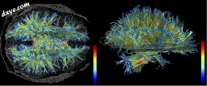 White matter structure of human brain (taken by MRI)..jpg