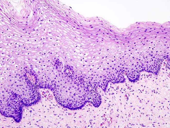 Normal cervical epithelium.jpg