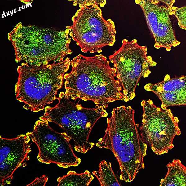 Molecular basis for melanoma cell motility.jpg