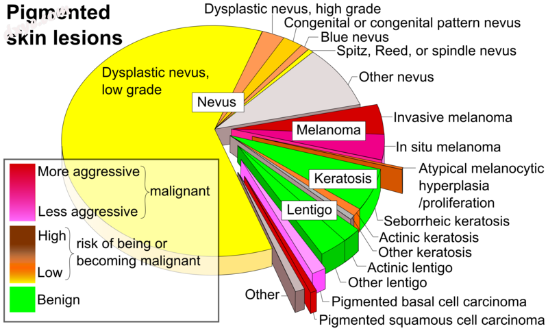 Various differential diagnoses of pigmented skin lesions, by.png