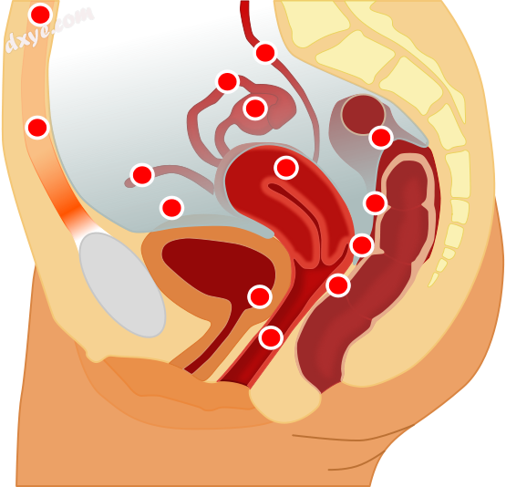 Possible locations of endometriosis.png