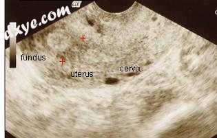 Ultrasound view..jpg