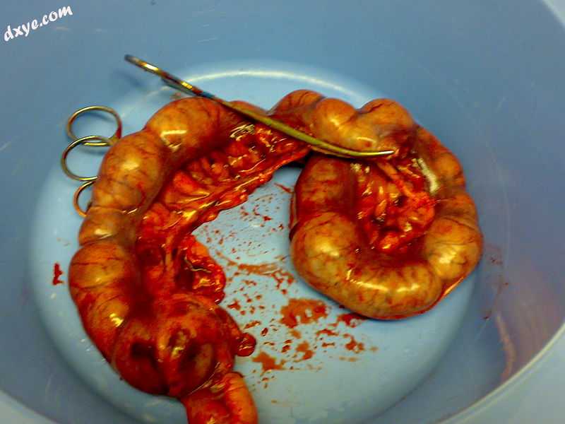 A canine pyometric uterus immediately after surgery to remove it. It is extremel.jpg