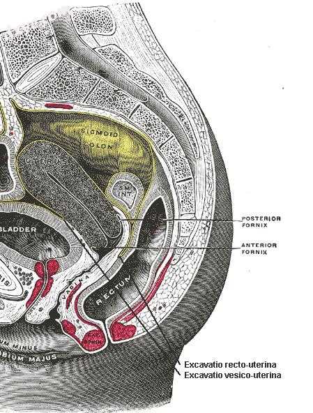 Sagittal section of the lower part of a female trunk, right segment. (Rectovagin.jpg