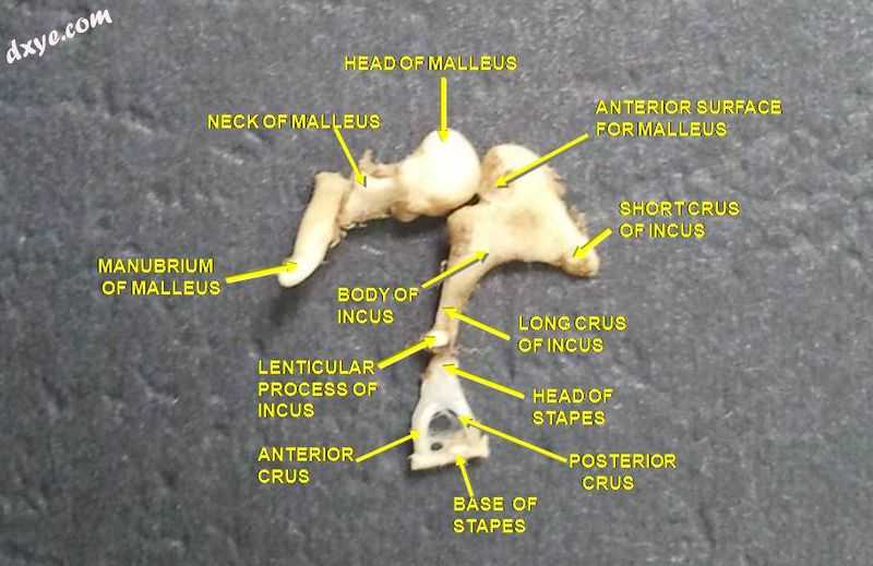 Auditory ossicles from a deep dissection of the tympani.jpg