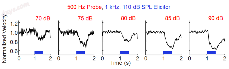 Examples of the onset and recovery of the acoustic reflex measured with a laser .png