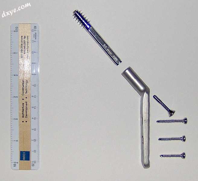 Dynamic hip screw.jpg