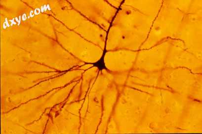 A human neocortical pyramidal neuron.jpg