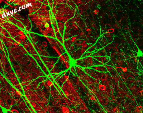 Pyramidal neuron visualized by green fluorescent protein.png