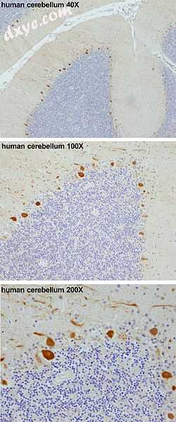 The 浦肯野细胞 protein 4 (PCP4) is markedly.jpg