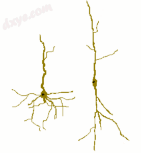 Cartoon of a normal 锥体细胞 (left) compared to a spindle cell (right)..png