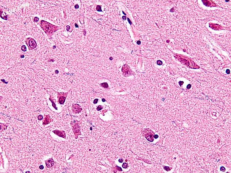 Micrograph showing a 纺锤体神经元 of the cingulate. HE-LFB stain..jpg