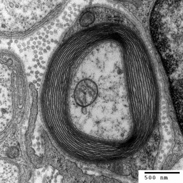 Transmission electron micrograph of a cross-section of a 髓磷脂ated PNS axon, ge.jpg