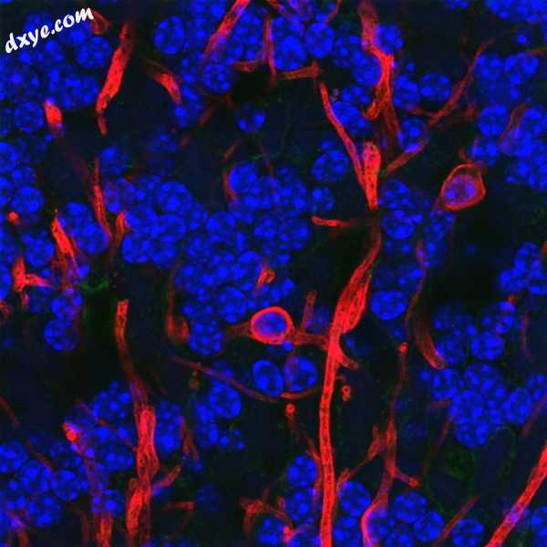 少突胶质细胞s in rat 小脑 stained with antibody to 髓磷脂 basic protein.jpg