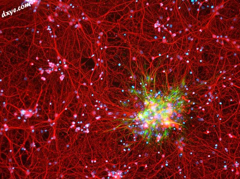 Astrocytes (green) in the context of neurons (red) in a mouse cortex cell culture.jpg