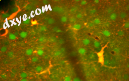 Astrocytes (red-yellow) among neurons (green) in the living cerebral cortex.png